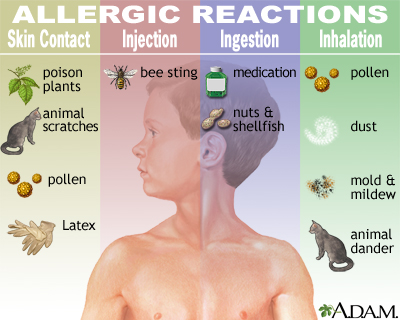 The spiritual Reasons behind Allergies